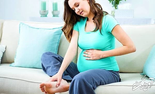 تورم پاها در بارداری